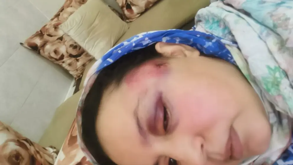 imatge de les agressions patides per Sultaha Khaya.